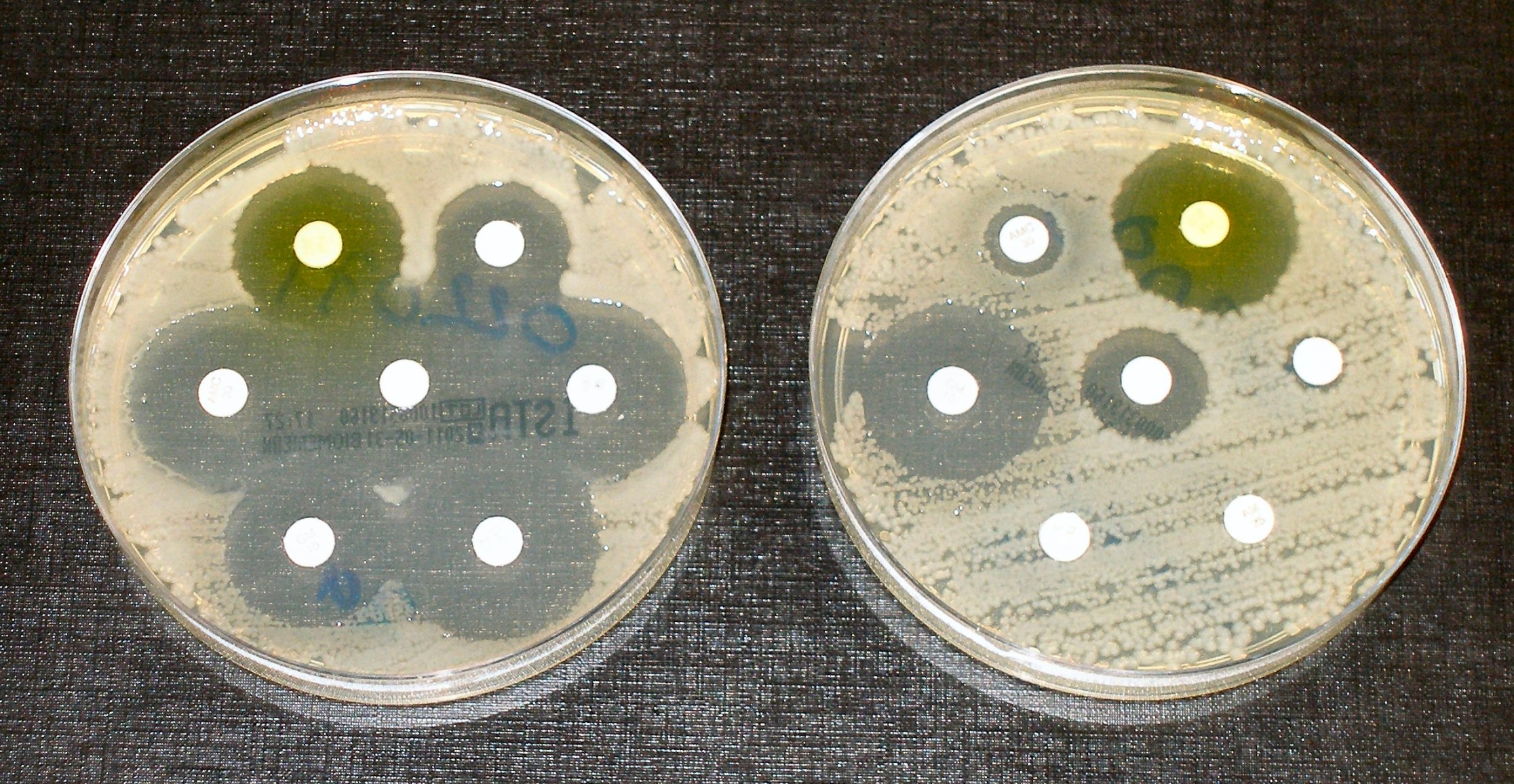 Antibiotic resistance tests. (Jan Hudzicki, ASM)