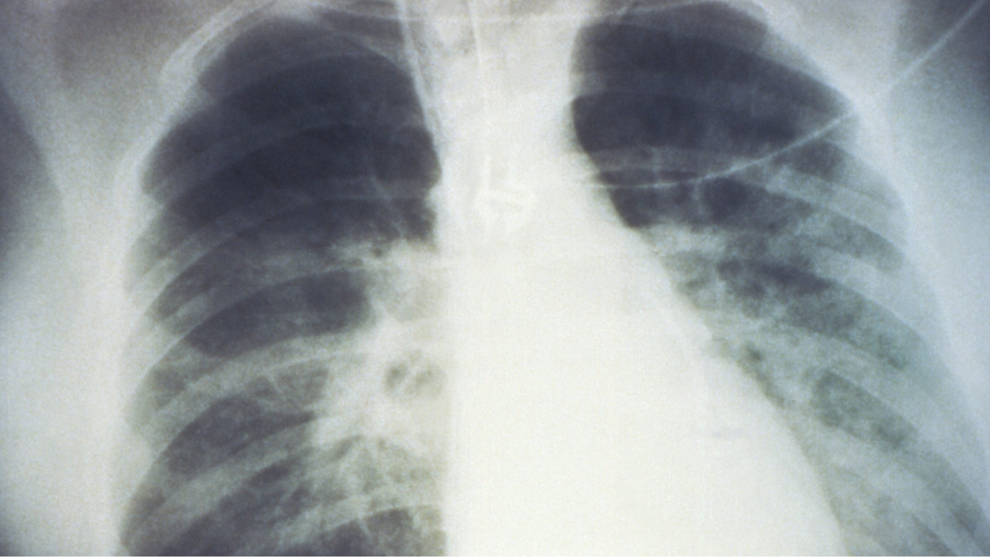 Understanding the Virus That Has the World on Aler 3
